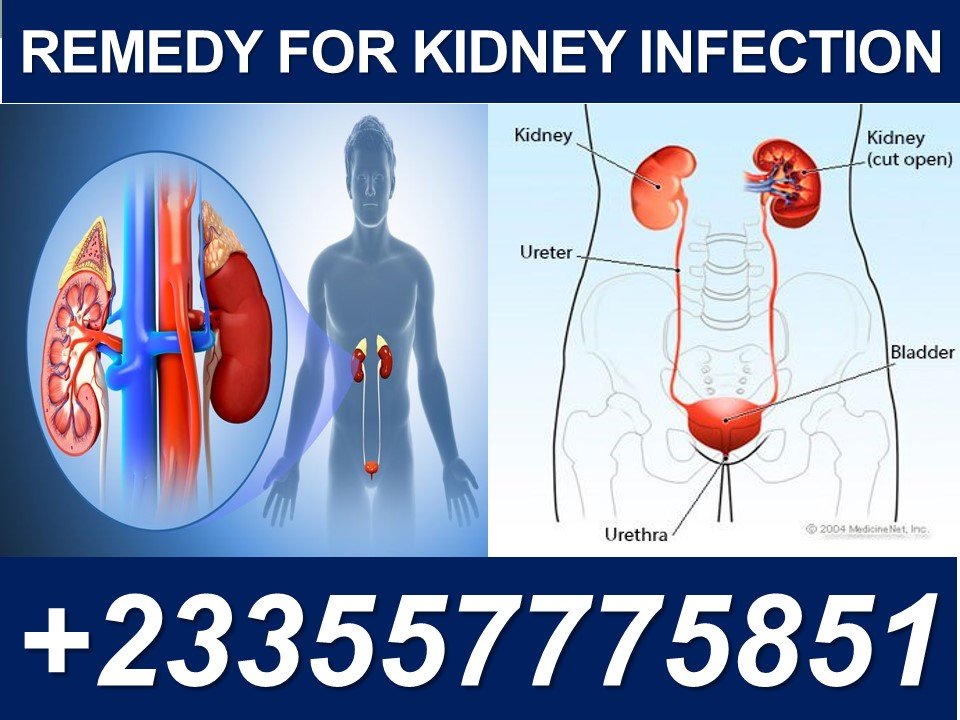 Treatment For Kidney Infection
