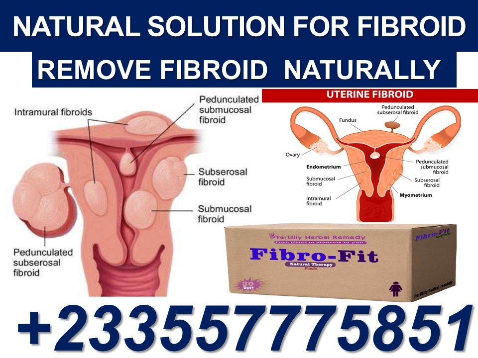 NATURAL TREATMENT FOR FIBROIDS