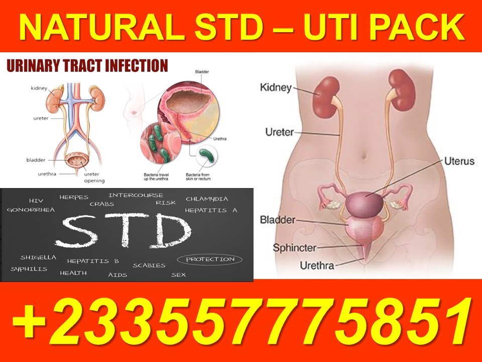 How to Treat Urinary Tract Infection