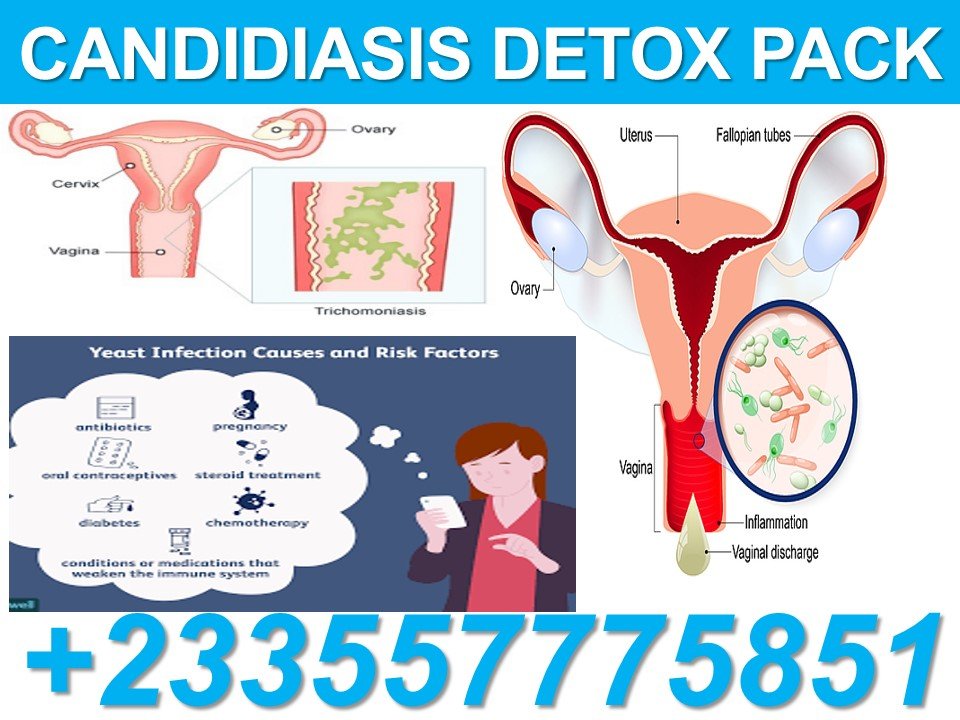 FOREVER LIVING PRODUCTS FOR CANDIDIASIS
