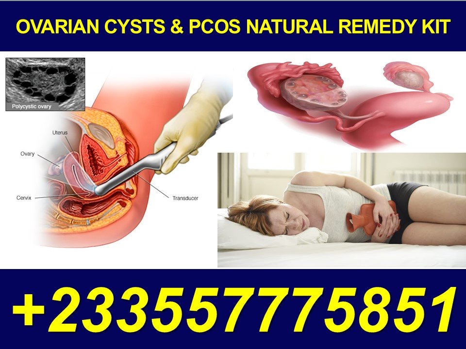 Ovarian Cysts Natural Treatment