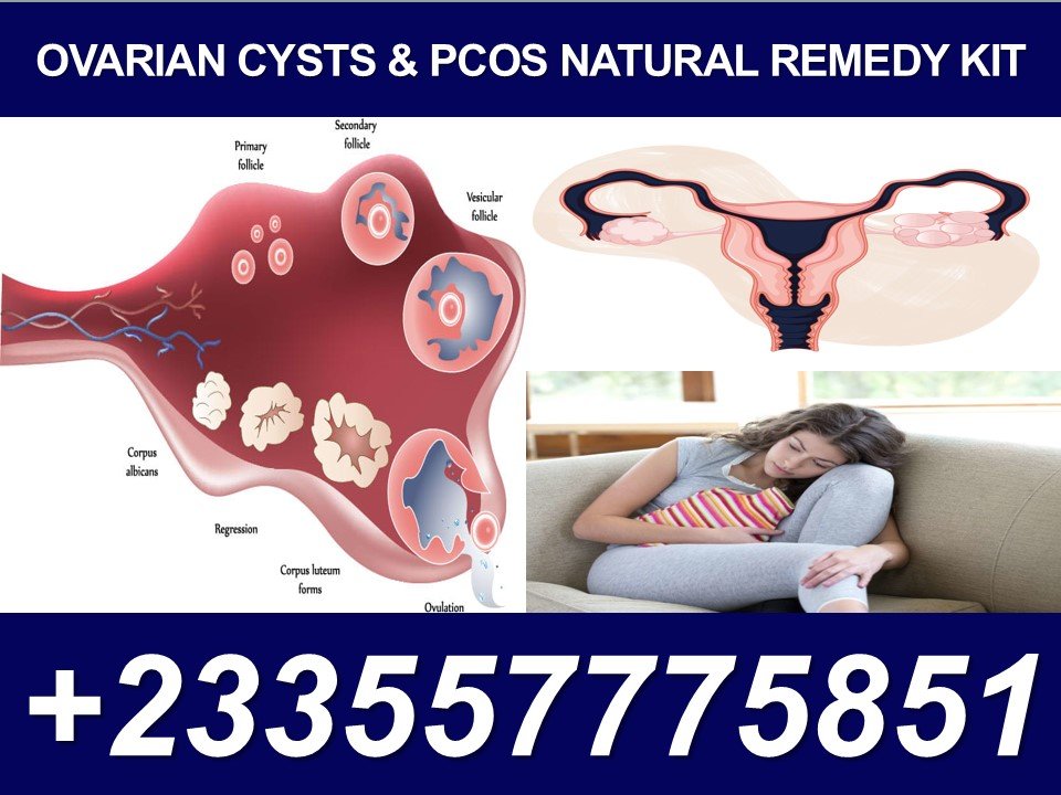 FOREVER PRODUCTS FOR OVARIAN CYSTS