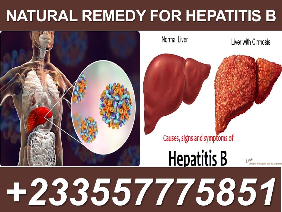 Natural Remedy For Hepatitis B