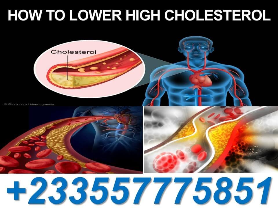Cholesterol Natural Solution Pack